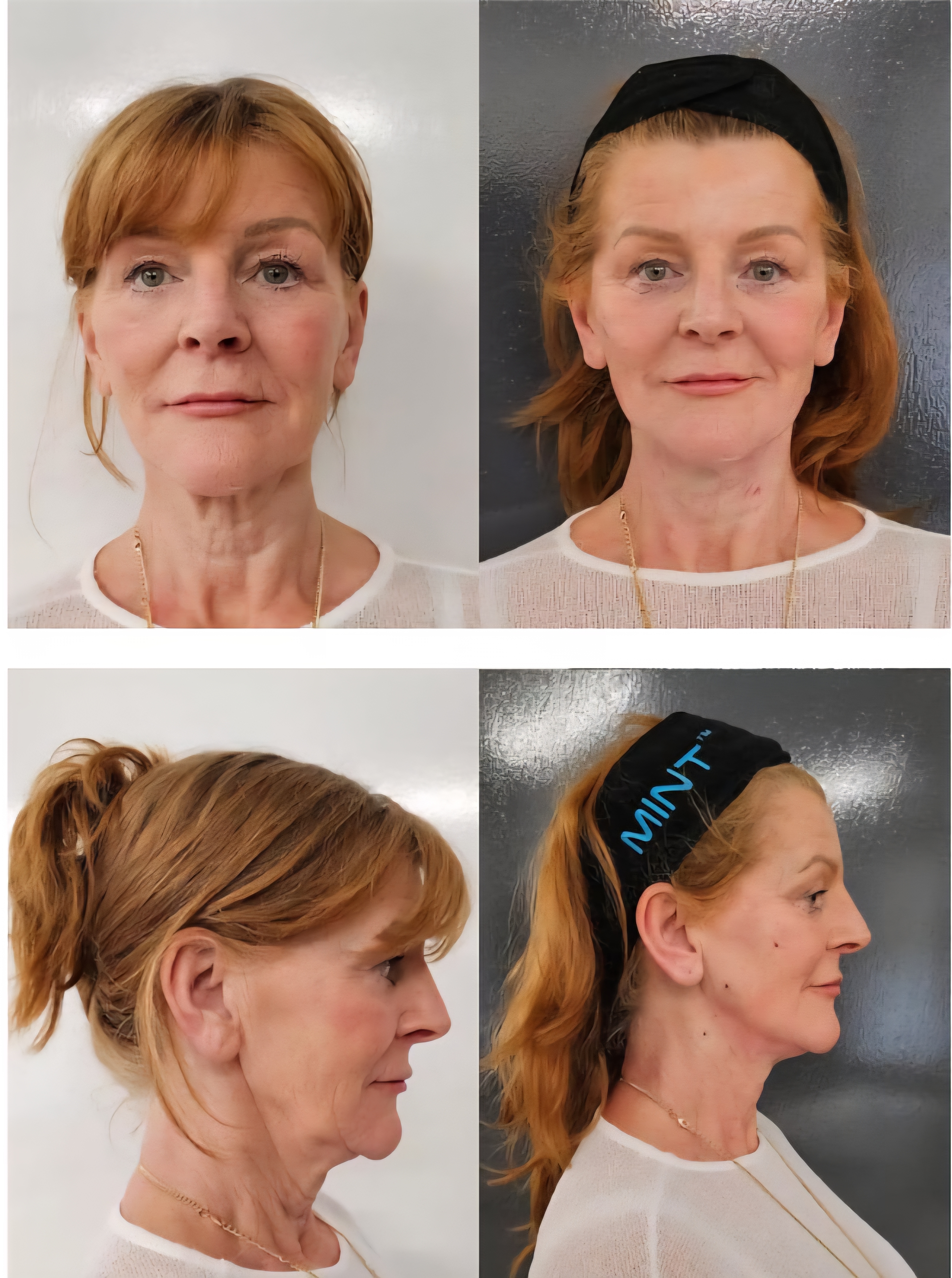 Treatment result